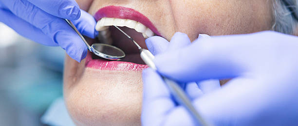 Best Emergency Treatment for Dental Infections or Abscesses in Vivian, LA